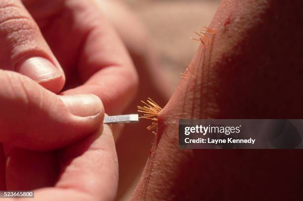 removing cactus needles from a hiker's leg - needle plant part stock pictures, royalty-free photos & images