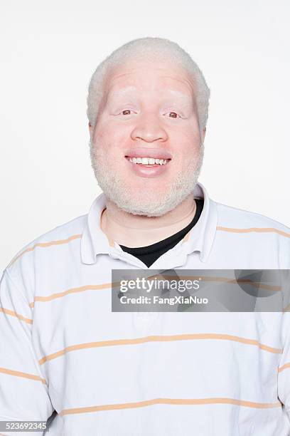 man smiling at camera - albino stock pictures, royalty-free photos & images