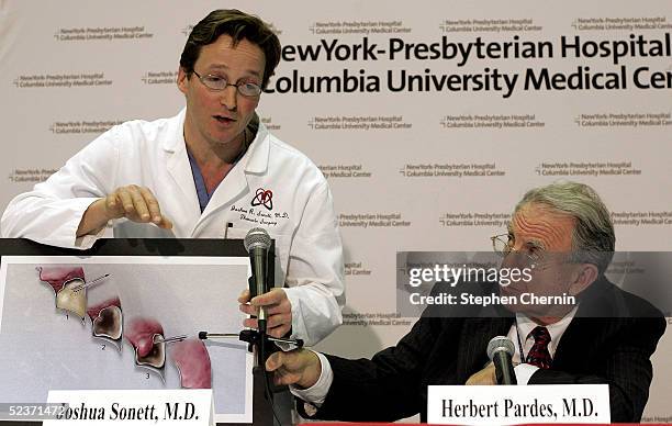 Thoracic surgeon Dr. Joshua Sonett , assisted by New York Presbyterian Hospital president and CEO Dr. Herbert Pardes holds a cross-section diagram of...