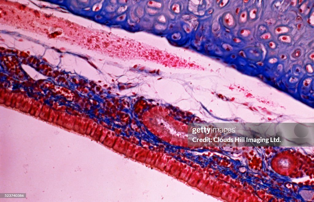 Transverse Section Of A Retina High-Res Stock Photo - Getty Images