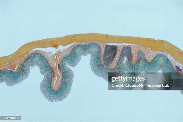 364 Transverse Colon Stock Photos, High-Res Pictures, and Images ...