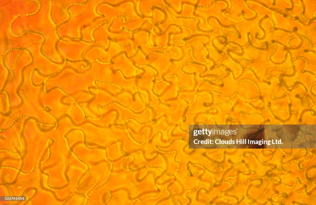 Anabaena Cyanobacteria