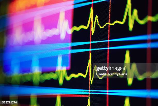 heart rate monitor - heartbeat foto e immagini stock