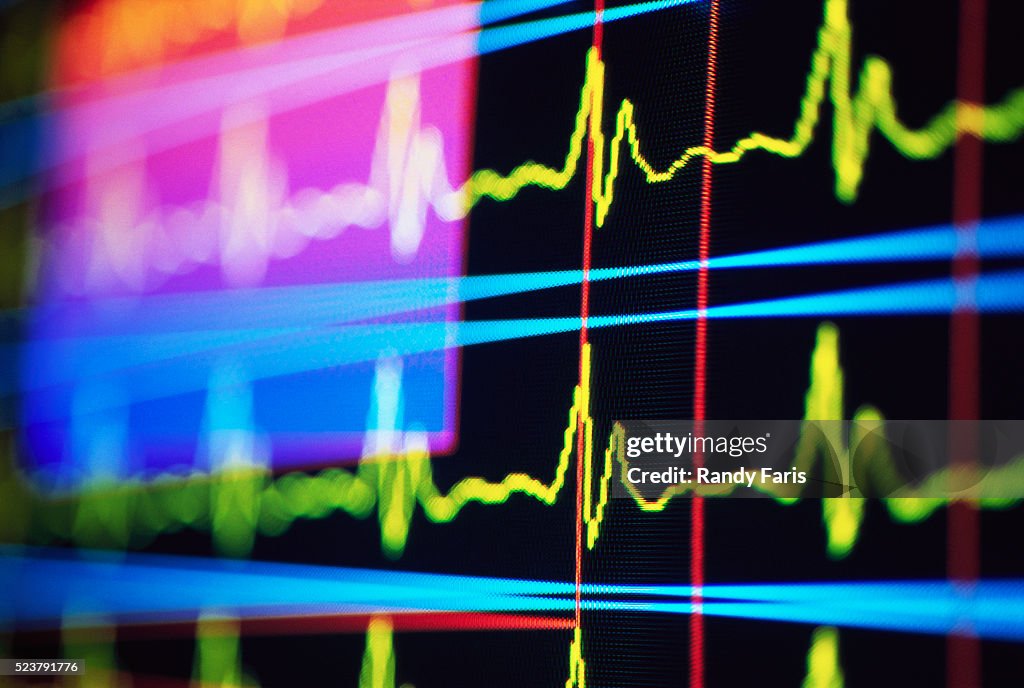 Heart Rate Monitor