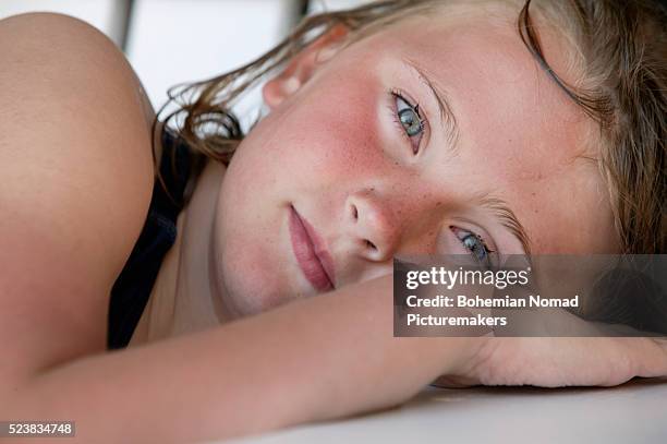 sunburned girl - heat rash stock pictures, royalty-free photos & images