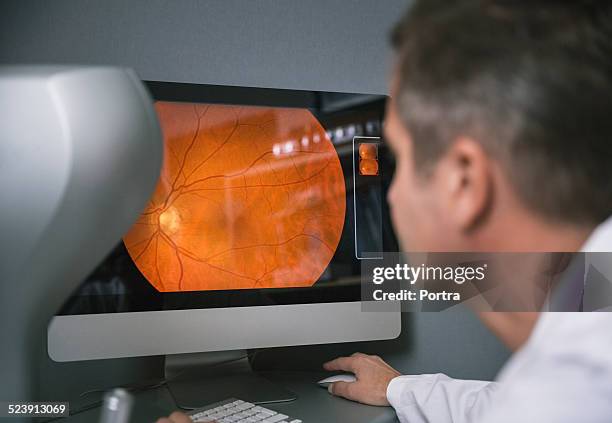 optometrist examining retina on computer in clinic - eye doctor stock-fotos und bilder