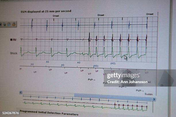 409 Defibrillator Patient Stock Photos, High-Res Pictures, and Images ...