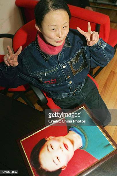 Chinese woman Zhang Jing, known as the "Ugly Girl" sits with a picture of how she used to look, at a plastic surgery hospital on March 18, 2005 in...
