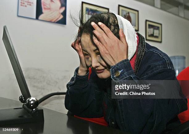 Chinese woman Zhang Jing, known as the "Ugly Girl" looks into a mirror after doctors removed the stitches from her fourth session of cosmetic surgery...