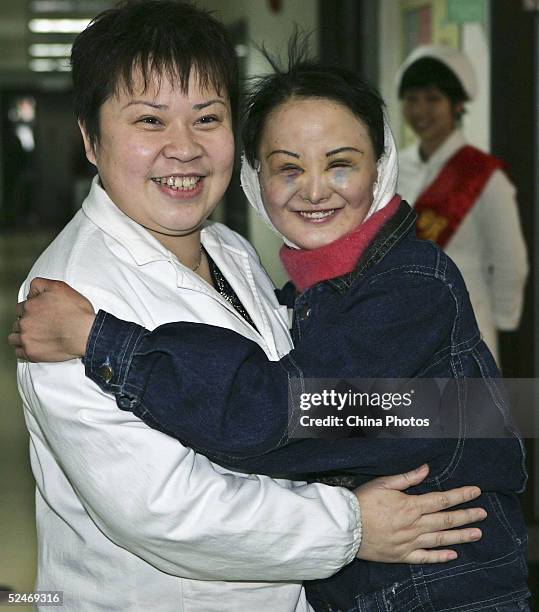 Chinese woman Zhang Jing, known as the "Ugly Girl" hugs the doctor who operated the cosmetic surgery on her at a hospital on March 23, 2005 in...