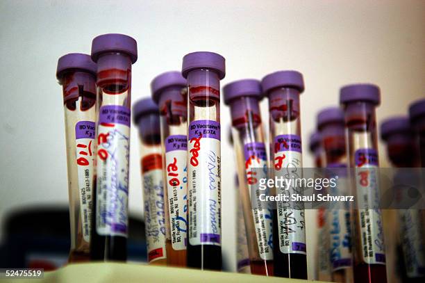 Blood tests wait to be inspected at the lab of Zanmi Lasante Hospital March 24, 2005 in Cange, Haiti. Many HIV positive patients come to be...