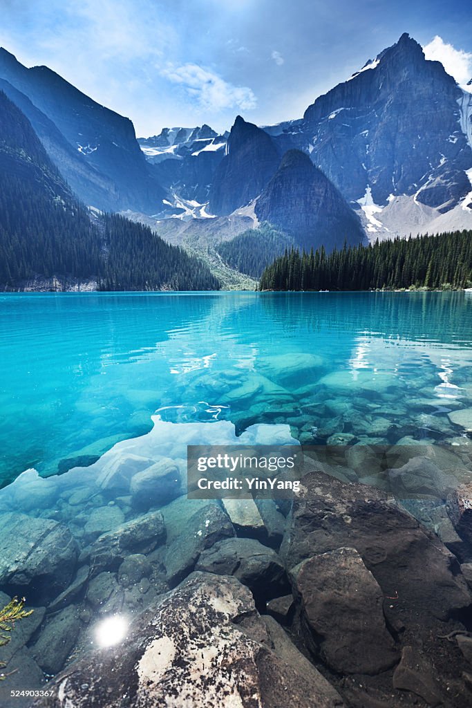 Lake Moraine, Banff National Park Emerald Water Landscape, Alberta, Canada