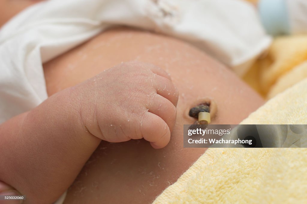 Close up umbilical cord