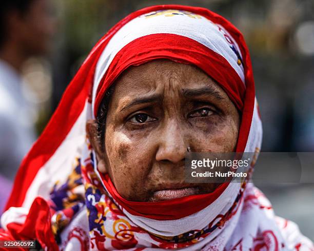 Survivors of acid attacks, attend a human chain to protest against acid violence on the eve of the International Women's Day celebration in Dhaka,...