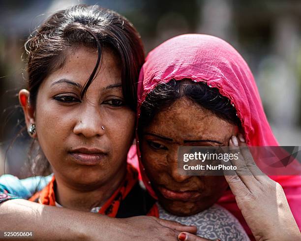 Survivors of acid attacks, attend a human chain to protest against acid violence on the eve of the International Women's Day celebration in Dhaka,...