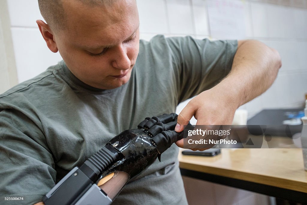 Ukraine Prosthetic Assistance Project for ATO soldiers