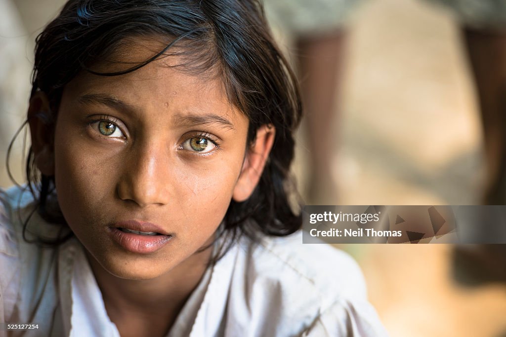 A Girl Suffering from Malaria Attends a Medical Clinic.