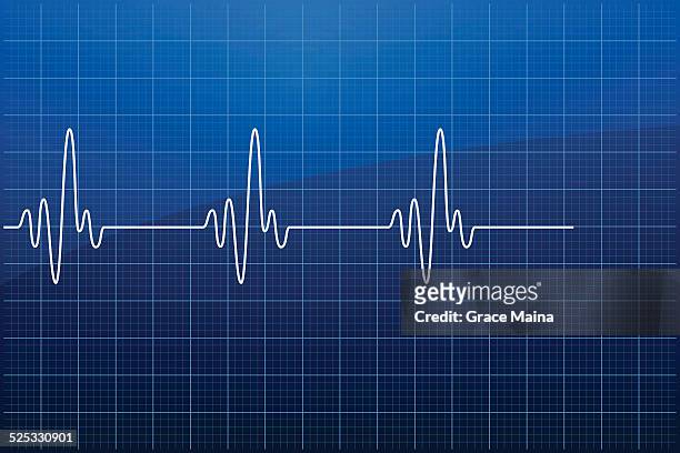 electrocardiogram ekg - vector - pulse trace stock illustrations
