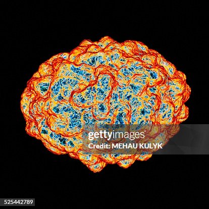 Smallpox virus, artwork Smallpox virus, artwork
