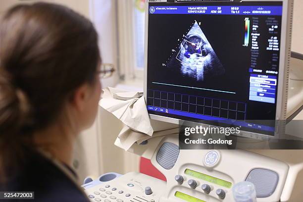 Echography Graphics 187 Echography Stock Photos, High-Res Pictures, and Images - Getty Images