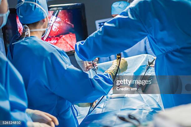 close up of surgeon operating a patient - laparoscopic surgery stock pictures, royalty-free photos & images