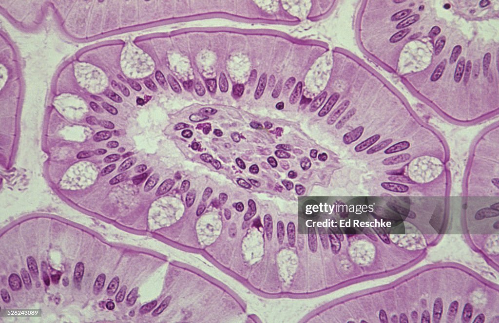 Villus cross section--simple columnar epithelium