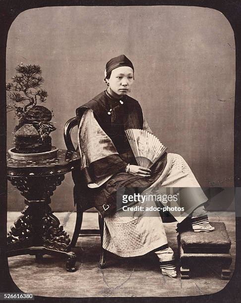 Unbandaged bound feet of a Chinese woman . Ca. 1870.