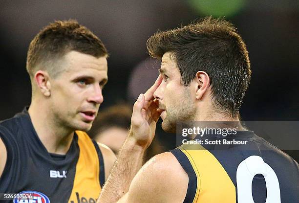 Trent Cotchin of the Tigers touches his fractured cheekbone as Brett Deledio reacts at full time after losing the round six AFL match between the...