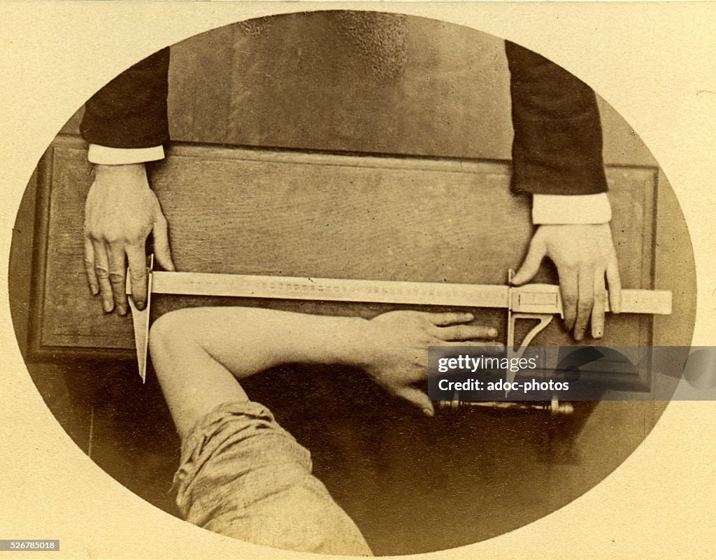 Bertillon System.drawing Anthropometric system of Alphonse Bertillon. Measurement of the... News ...