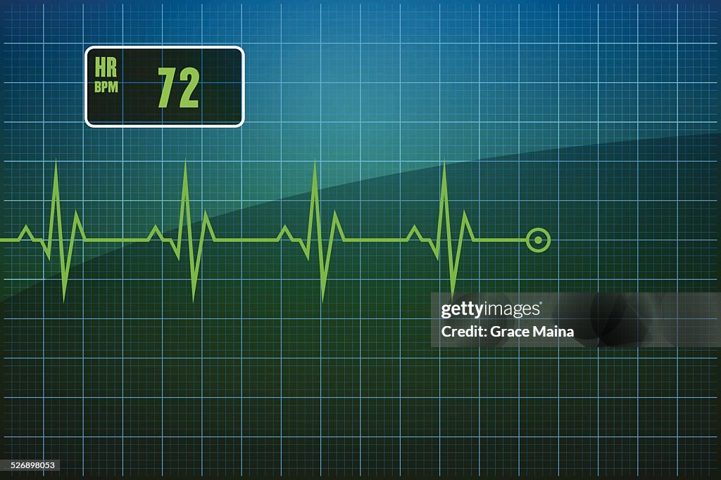 Electrocardiogram EKG-vetor