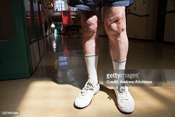 An elderly Irish prisoner's legs are scarred from being 'knee capped', a form of malicious wounding, often as criminal punishment or torture, in...