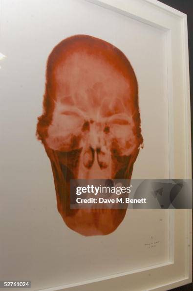 Ray Hitlér X-ray skull portrait of Adolf Hitler based on a full frontal X-ray of ...