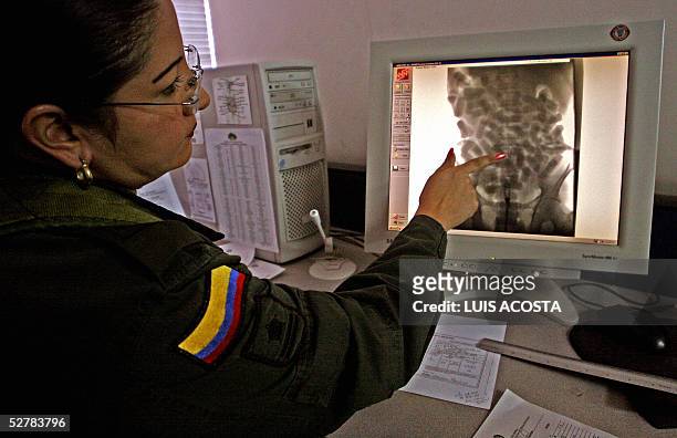 Un miembro de la Policia Antinarcoticos muestra una radiografia del abdomen de un correo de drogas, de los denominados "Mulas", en el muelle...