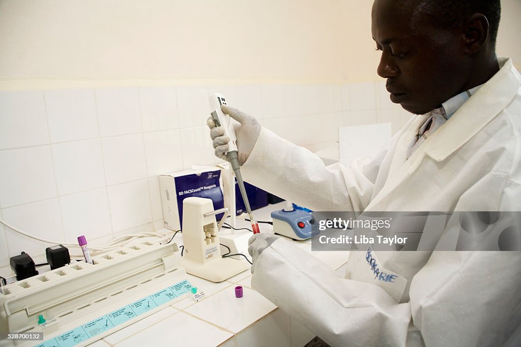 Doctor Testing Blood Sample for HIV and AIDS