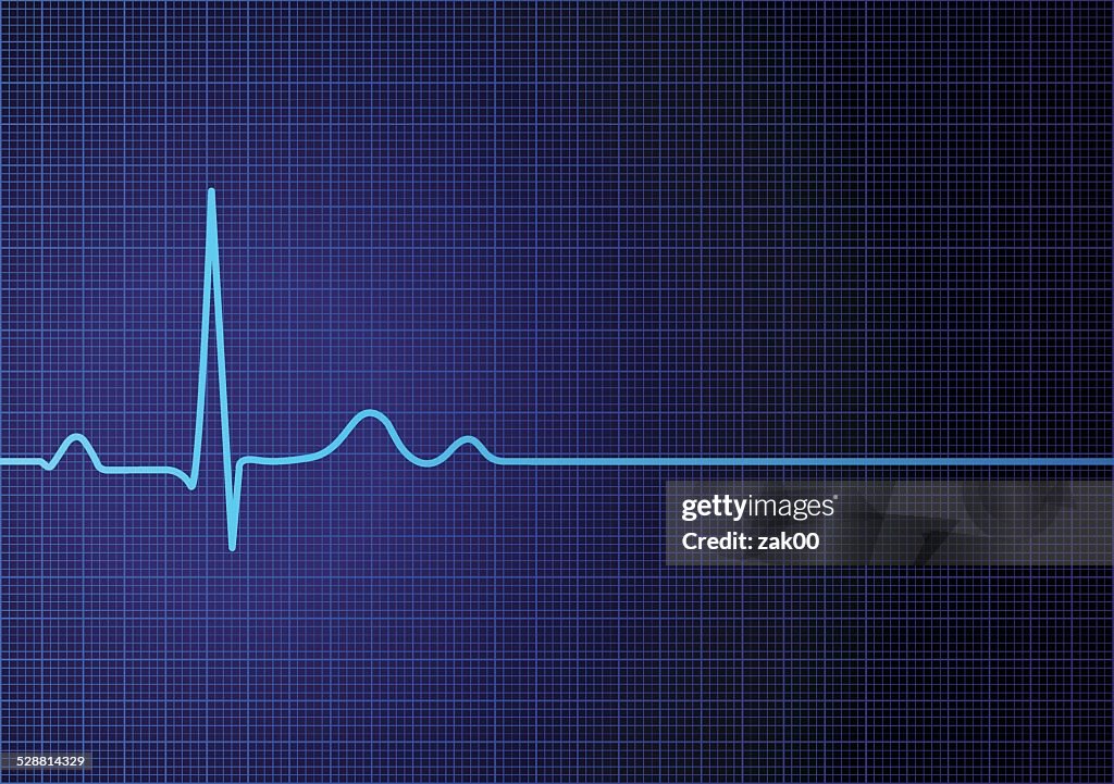 Flache Linie EKG