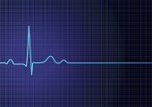 Flat line EKG