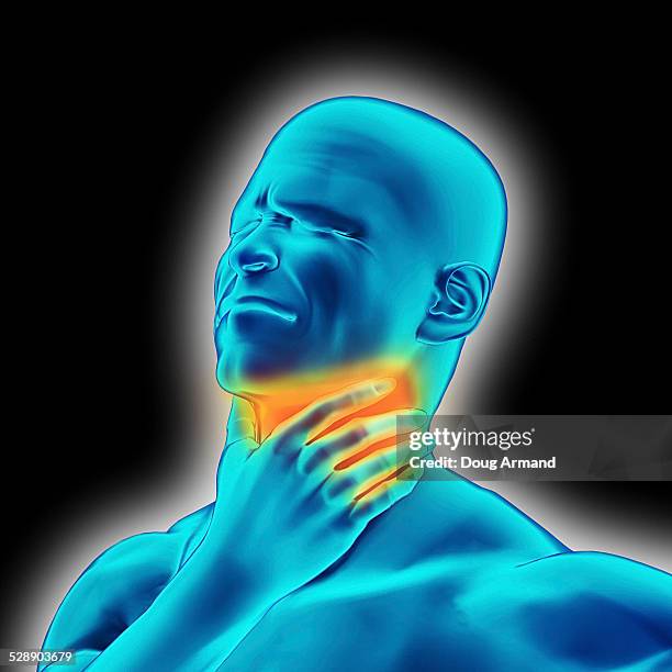 image representing a sore throat - sore throat stock illustrations