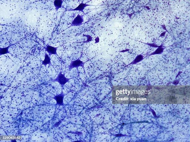 normal nerve cells,100x light micrograph - lichtmicroscopische-foto stockfoto's en -beelden