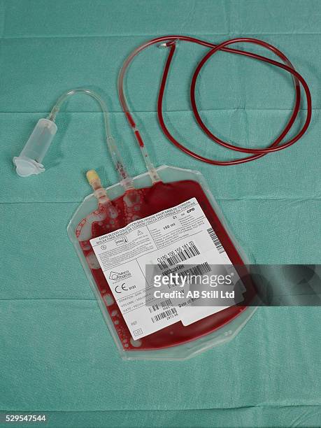 cord blood for stem cell harvesting - blood bag stock pictures, royalty-free photos & images