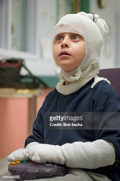 girl playing video game in hospital - eczema child stock-fotos und bilder