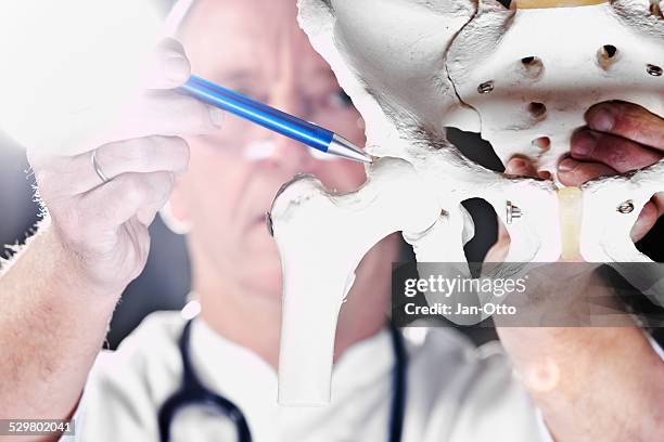 doctor pointing at hip joint - heup stockfoto's en -beelden