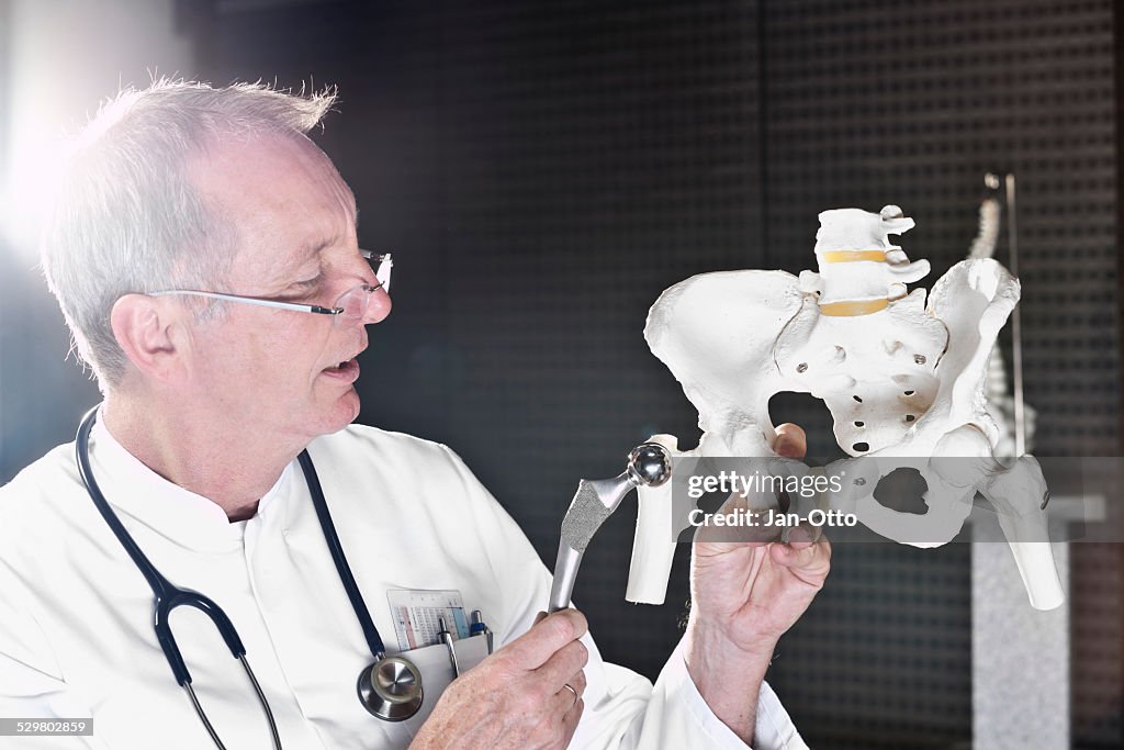 Doctor demonstrating total hip endoprothesis