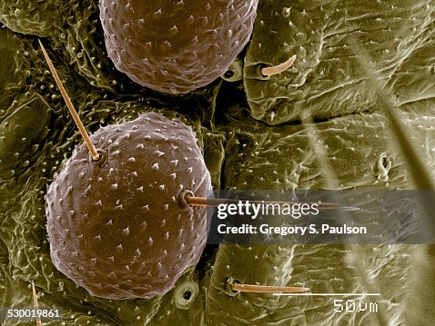 Ladybug Piles Abdomen Of Ladybug Larva Coccinellidae Sem High-Res Stock Photo - Getty ...