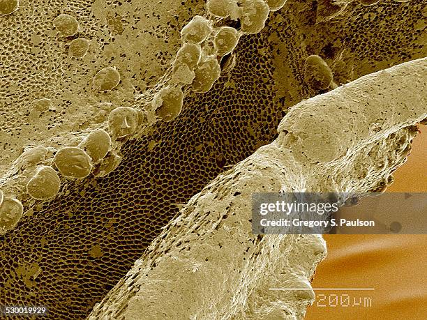 Sulcus (Anatomy) Photos and Premium High Res Pictures - Getty Images