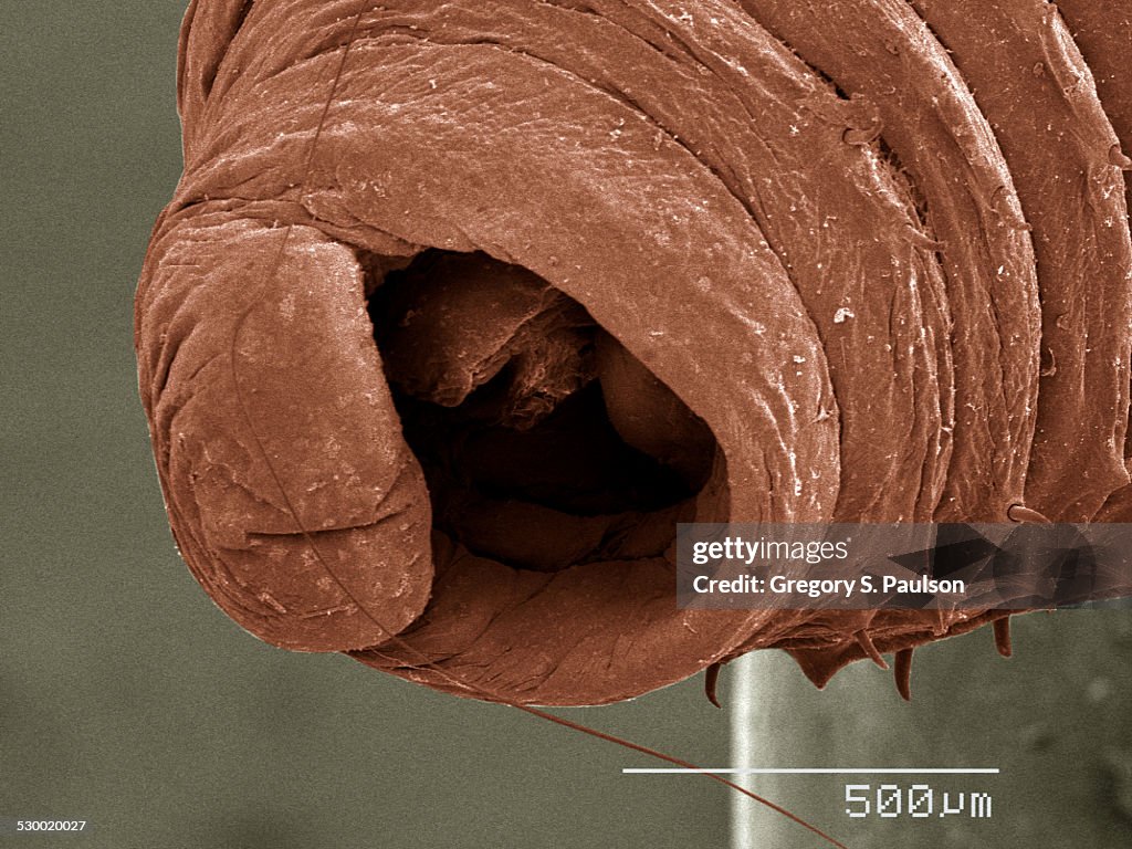 Mouth of Oligochaete worm SEM