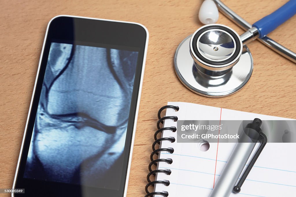 Technology use in healthcare. Smartphone displays an X-ray CT scan of a knee, acoustic stethoscope, notepad, and pen on doctors office desk