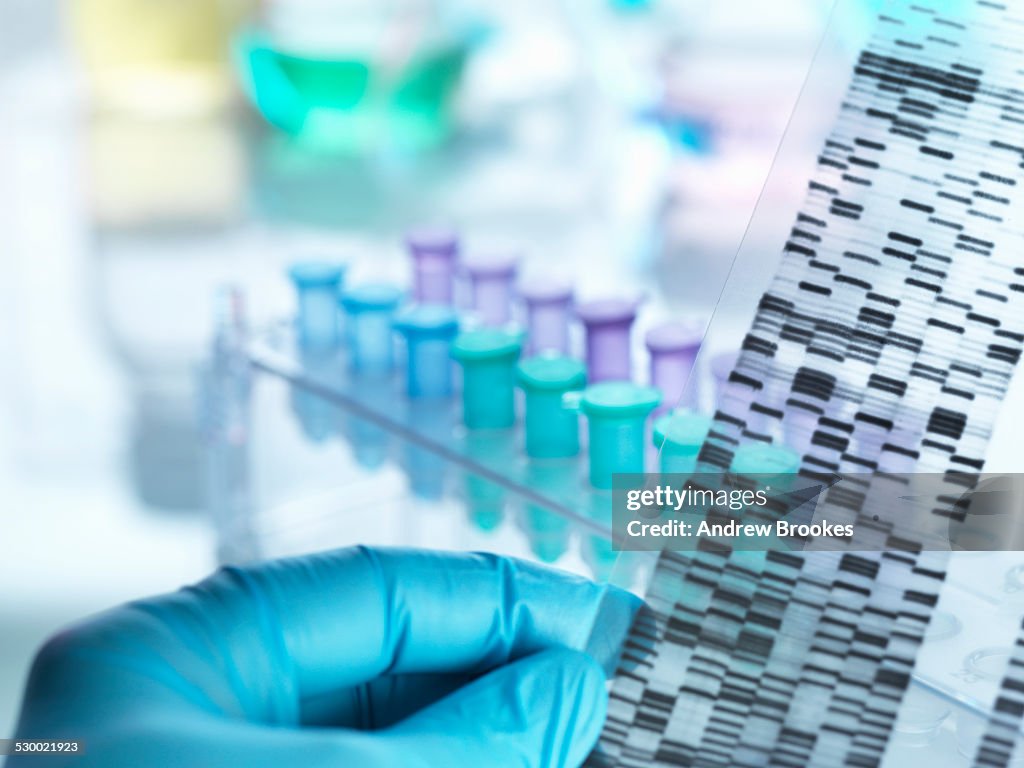 Scientist holding DNA gel in front of samples for testing in laboratory