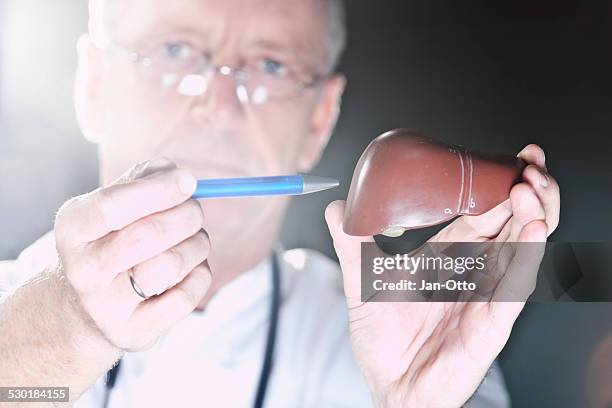 doctor pointing at liver - cirrhosis 個照片及圖片檔