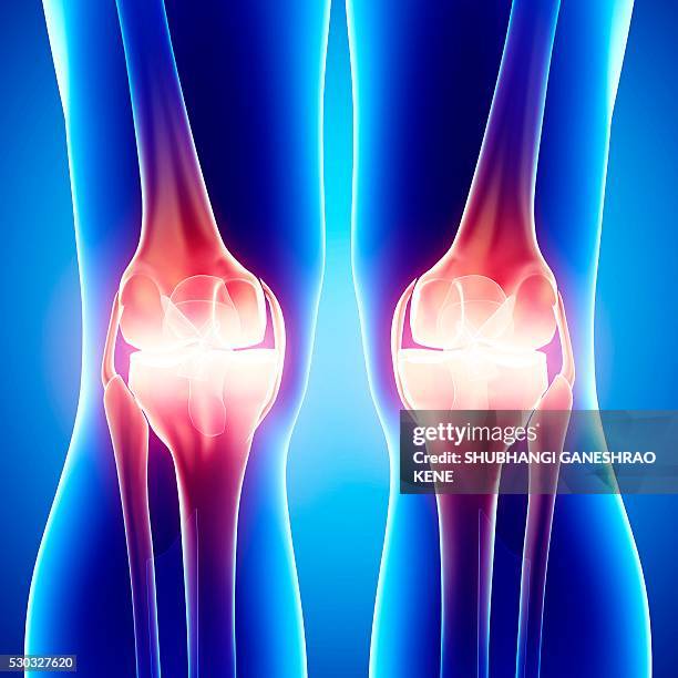 Front Rise Knee 318 Knee Pain Front Stock Photos, High-Res Pictures, and Images - Getty ...