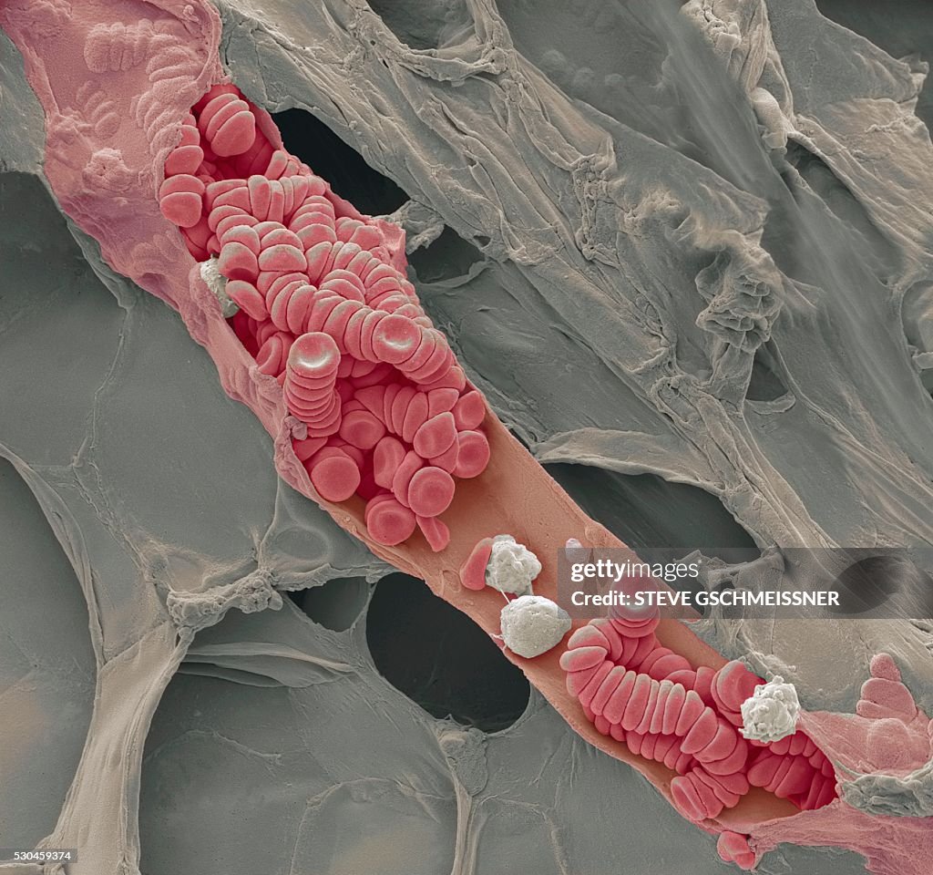 Ruptured venule, SEM